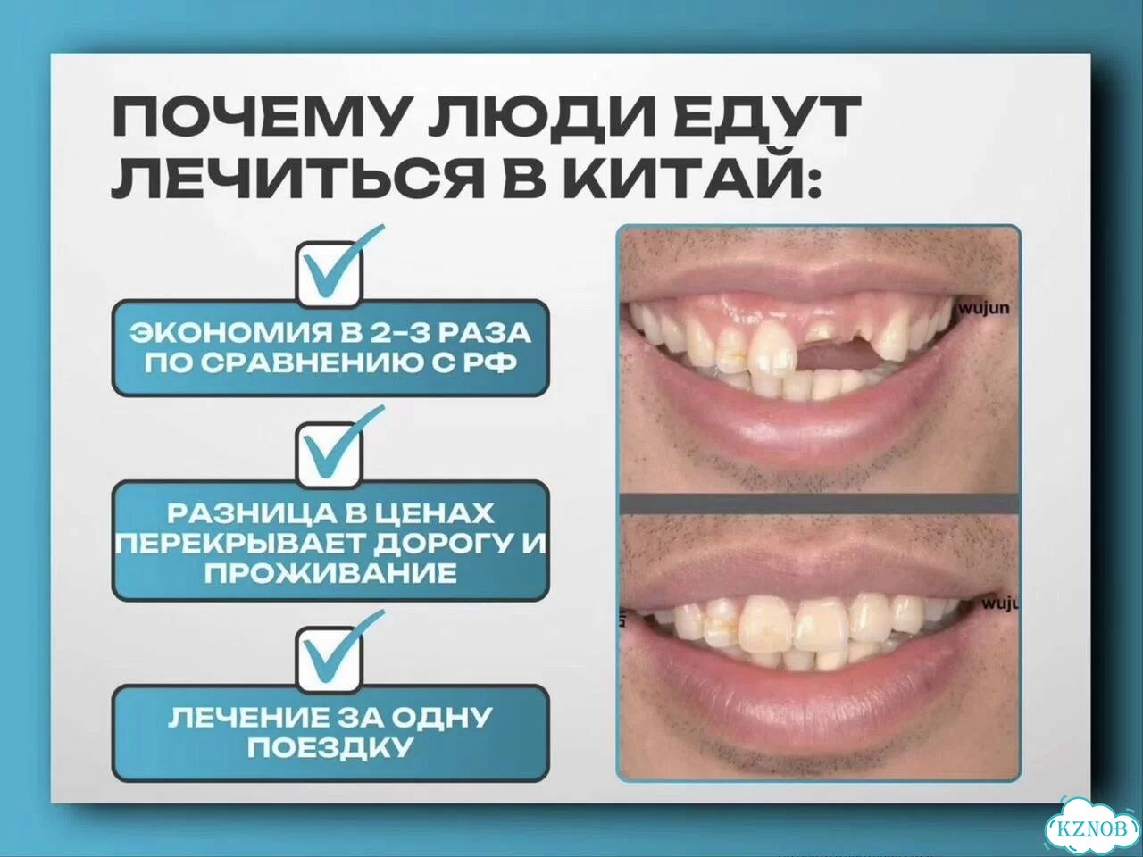 Лечение, протезирование, имплантация зубов в Китае фото 3