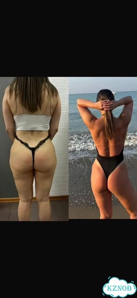 Аппаратный массаж антицеллюлитный фото 3
